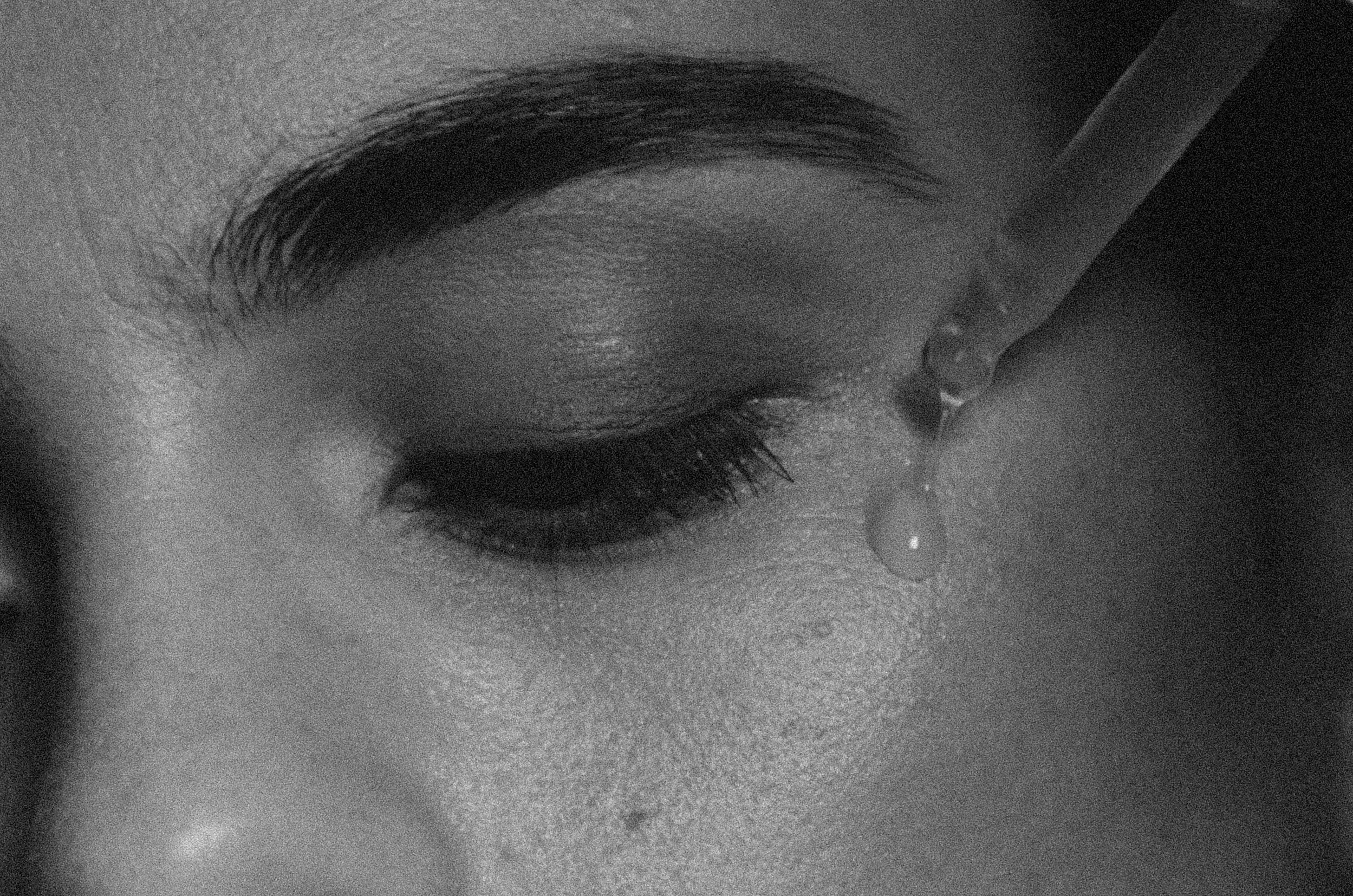 Retinol, Explained (Without the Hype)